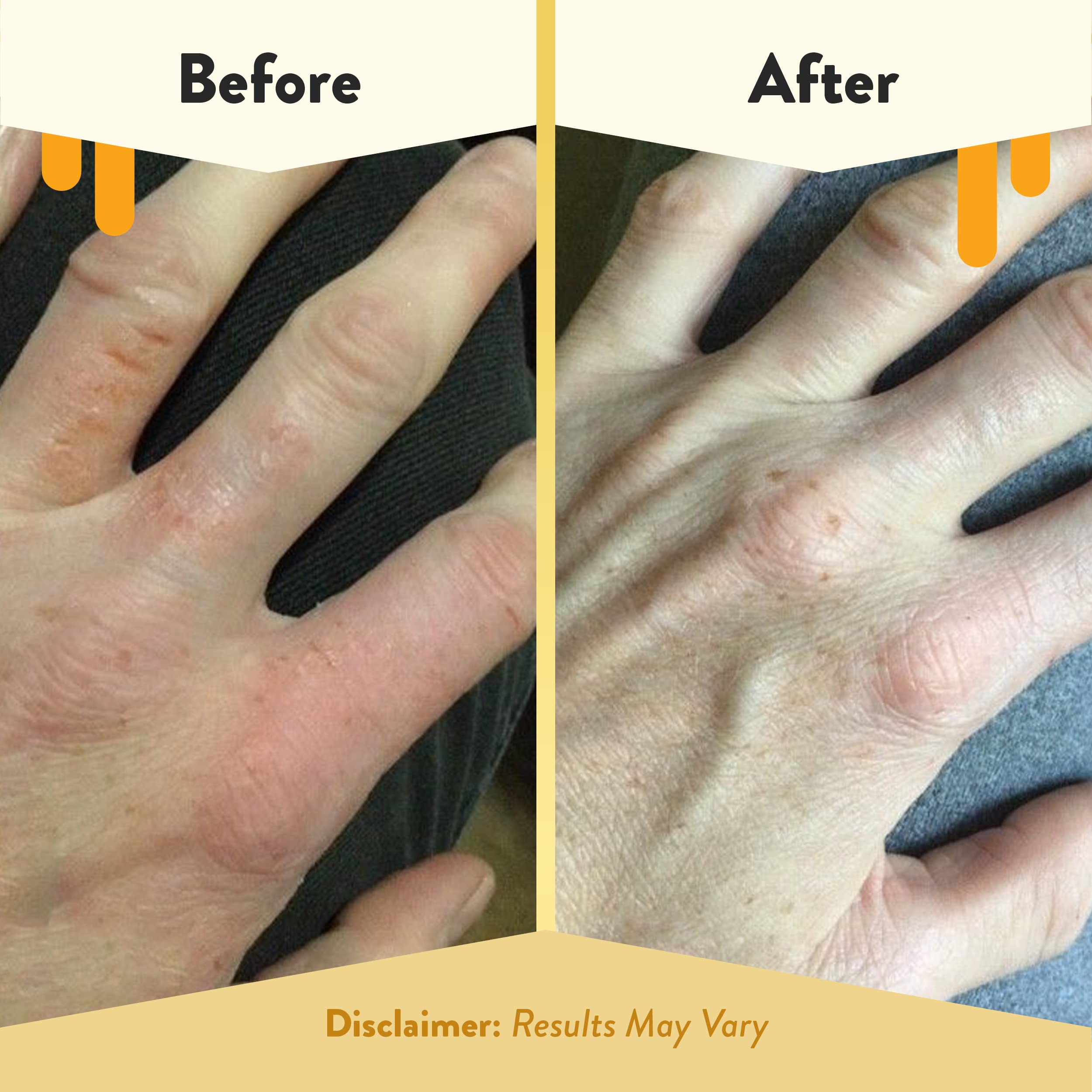 ECZEMA HONEY envase-cuatro-onzas listo para llevar y aplicar.