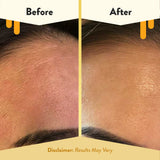 Fórmula sin químicos y libre de crueldad de ECZEMA HONEY