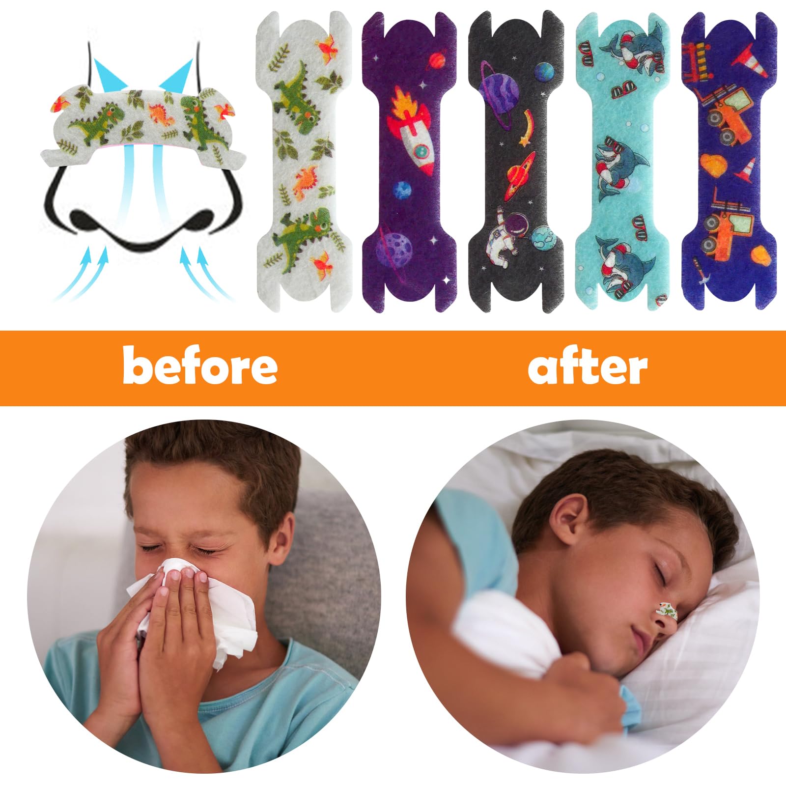Colocación correcta de la tira nasal ElasignShopo para adherencia estable.