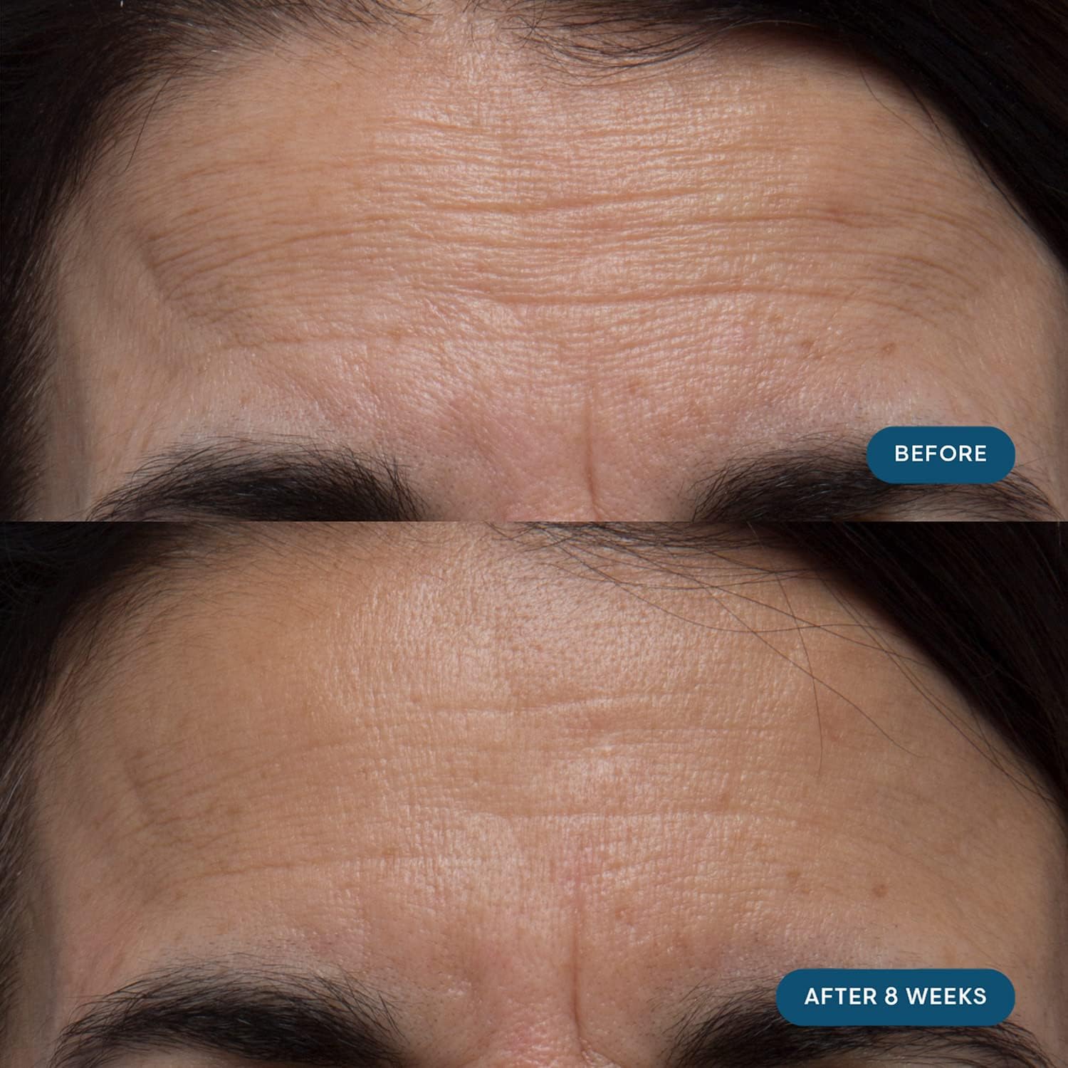 ELEMIS Pro-Collagen Skin Future: bote de cápsulas para uso diario y cuidado de la piel