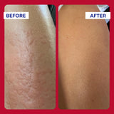 Alivio para piel irritada y dermatitis leve.