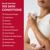 EMUAIDMAX Ungüento, eczema con alivio de irritaciones y mayor comodidad.