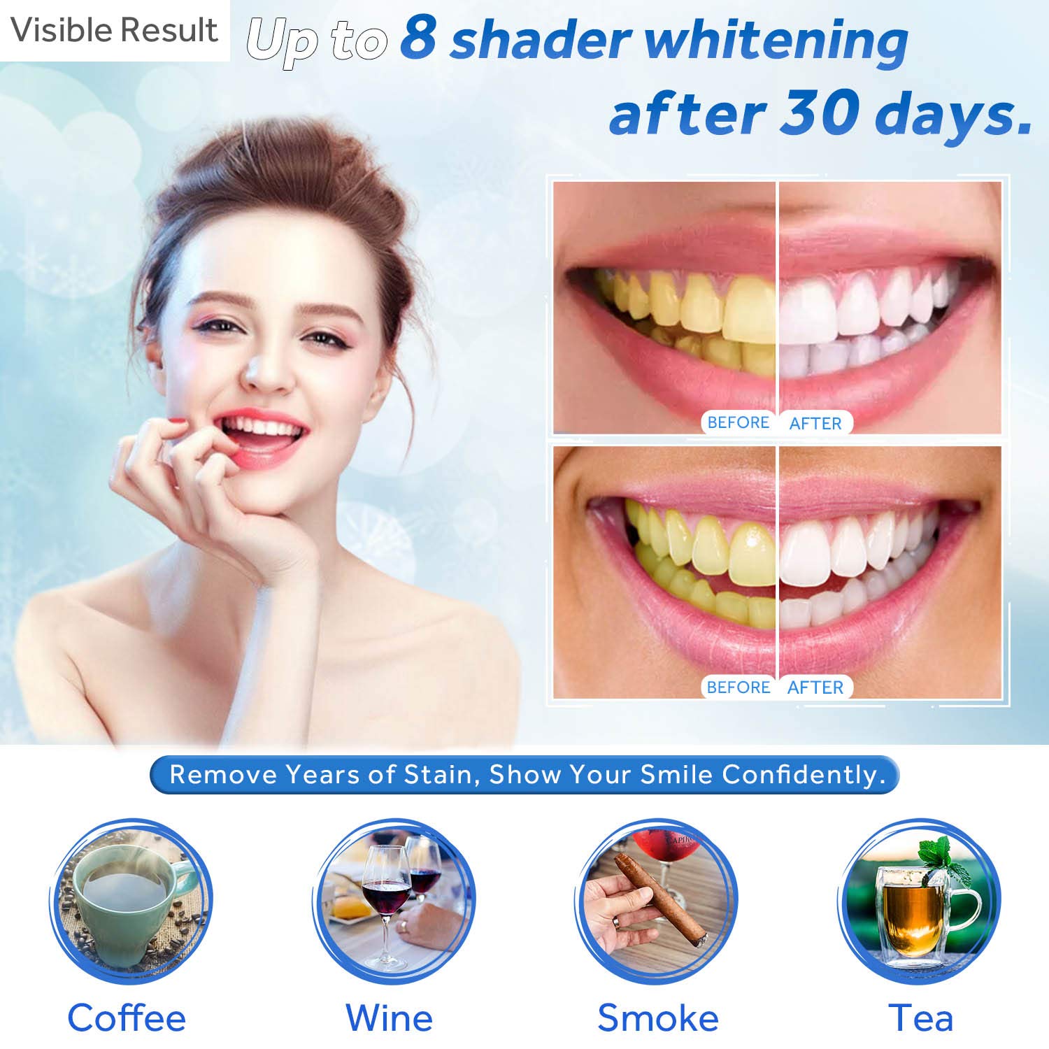 EZGO gel blanqueador 22% peróxido de carbamida, ideal para dientes sensibles.