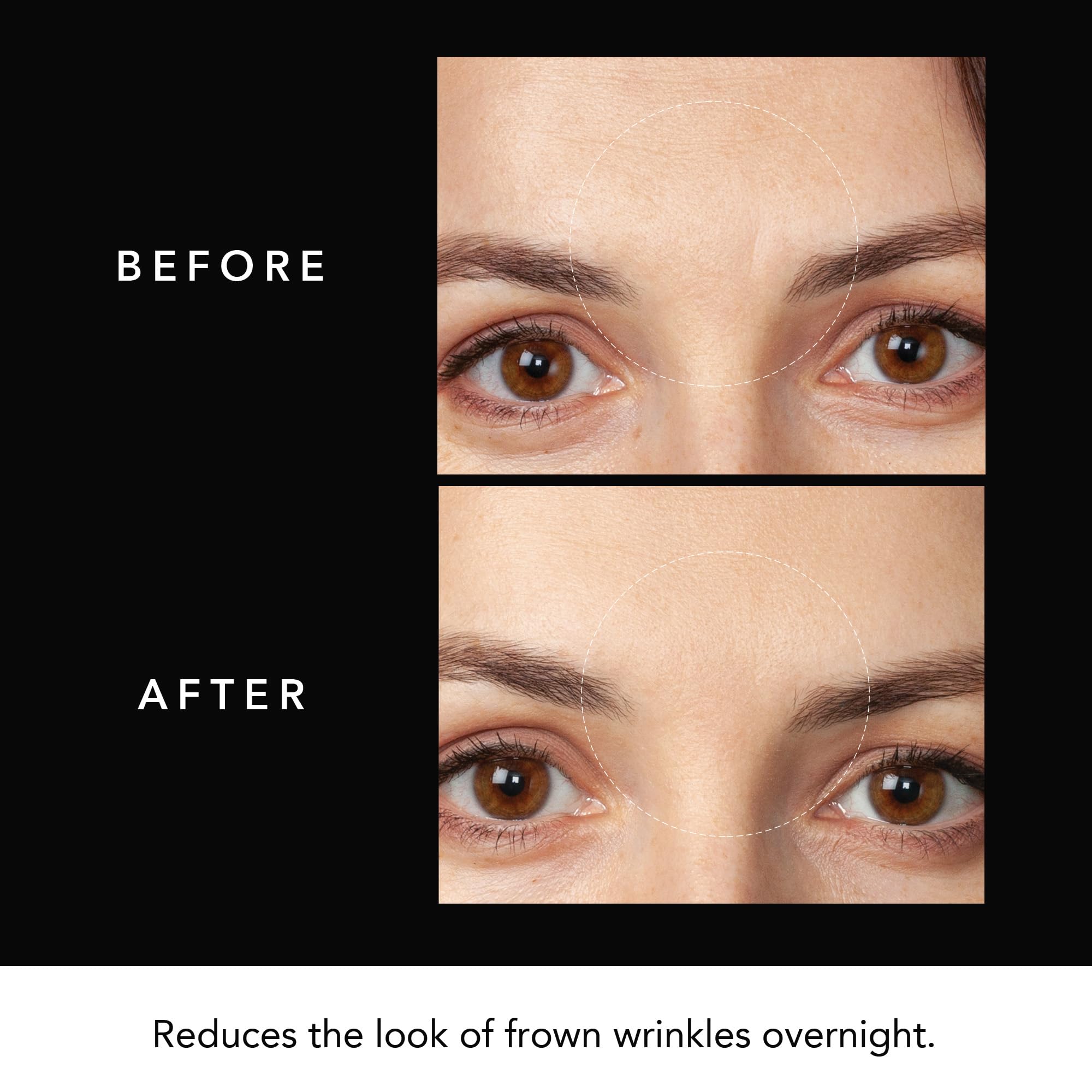 Parches FAQ para frente, textura suave y absorción rápida