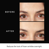 Parches FAQ para frente, textura suave y absorción rápida