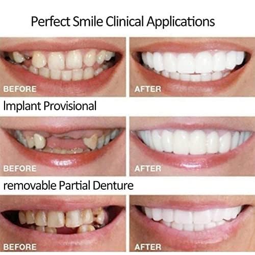 Generic Smile Temporal cubre dientes dañados para un aspecto más uniforme.