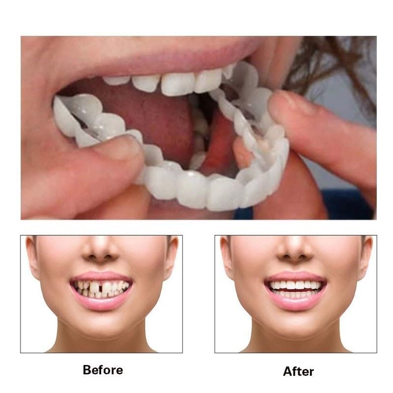 Generic Smile Temporal con diseño ultrafino para uso cómodo todo el día.