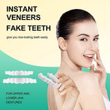 Generic Smile Temporal kit de blanqueamiento para una sonrisa más luminosa.
