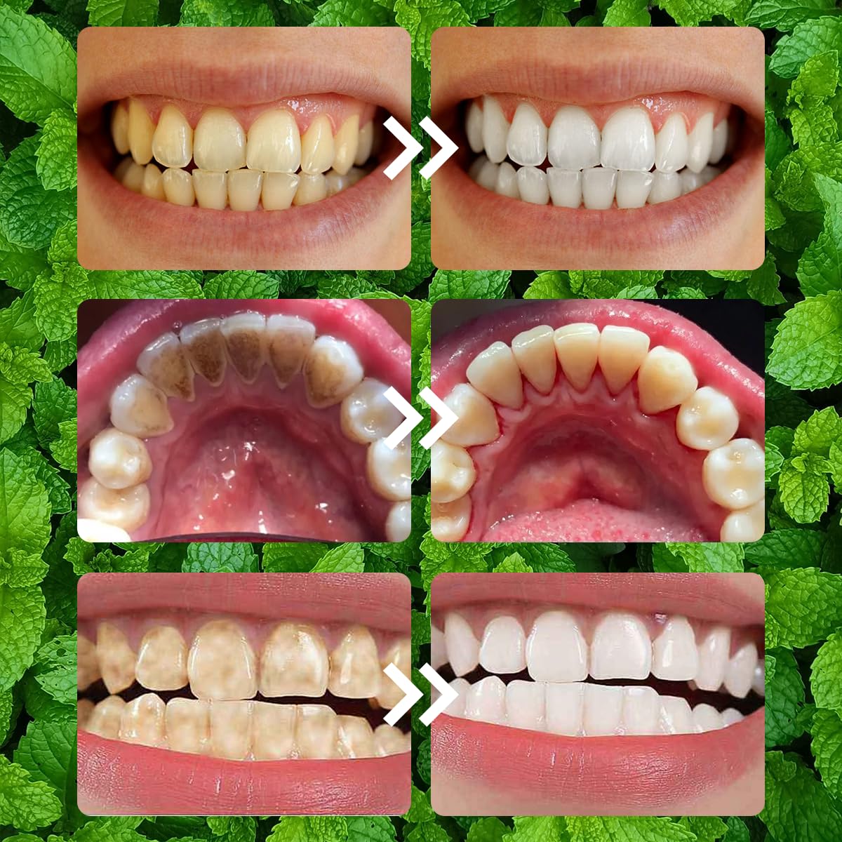 ginolmis polvo-dental-refrescante mantiene aliento fresco durante el día