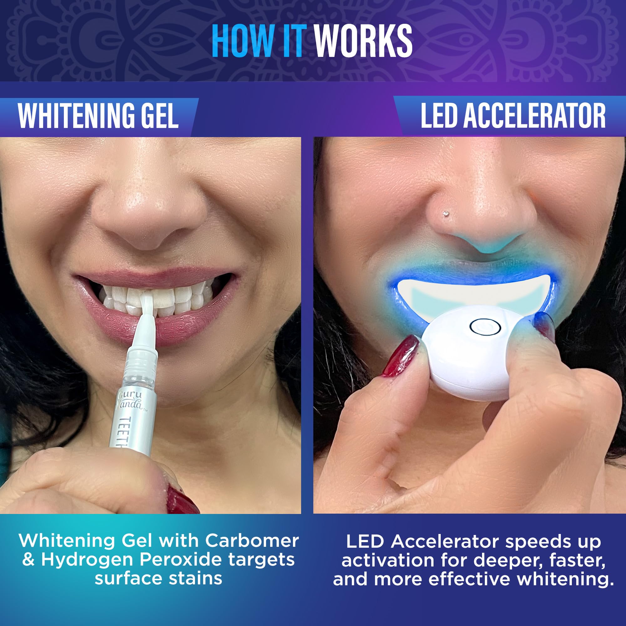 GuruNanda gel blanqueador con peróxido de hidrógeno para manchas superficiales.