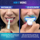 GuruNanda gel blanqueador con peróxido de hidrógeno para manchas superficiales.