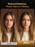 HALIDODO luz naranja facial para sesiones diarias versátiles
