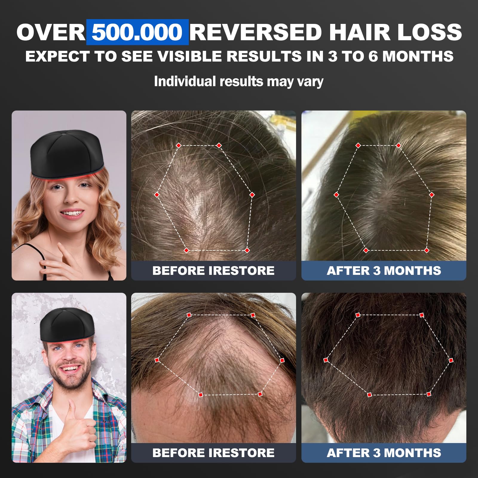 HAUBAT Laser Cap: diseño con confort para uso prolongado.
