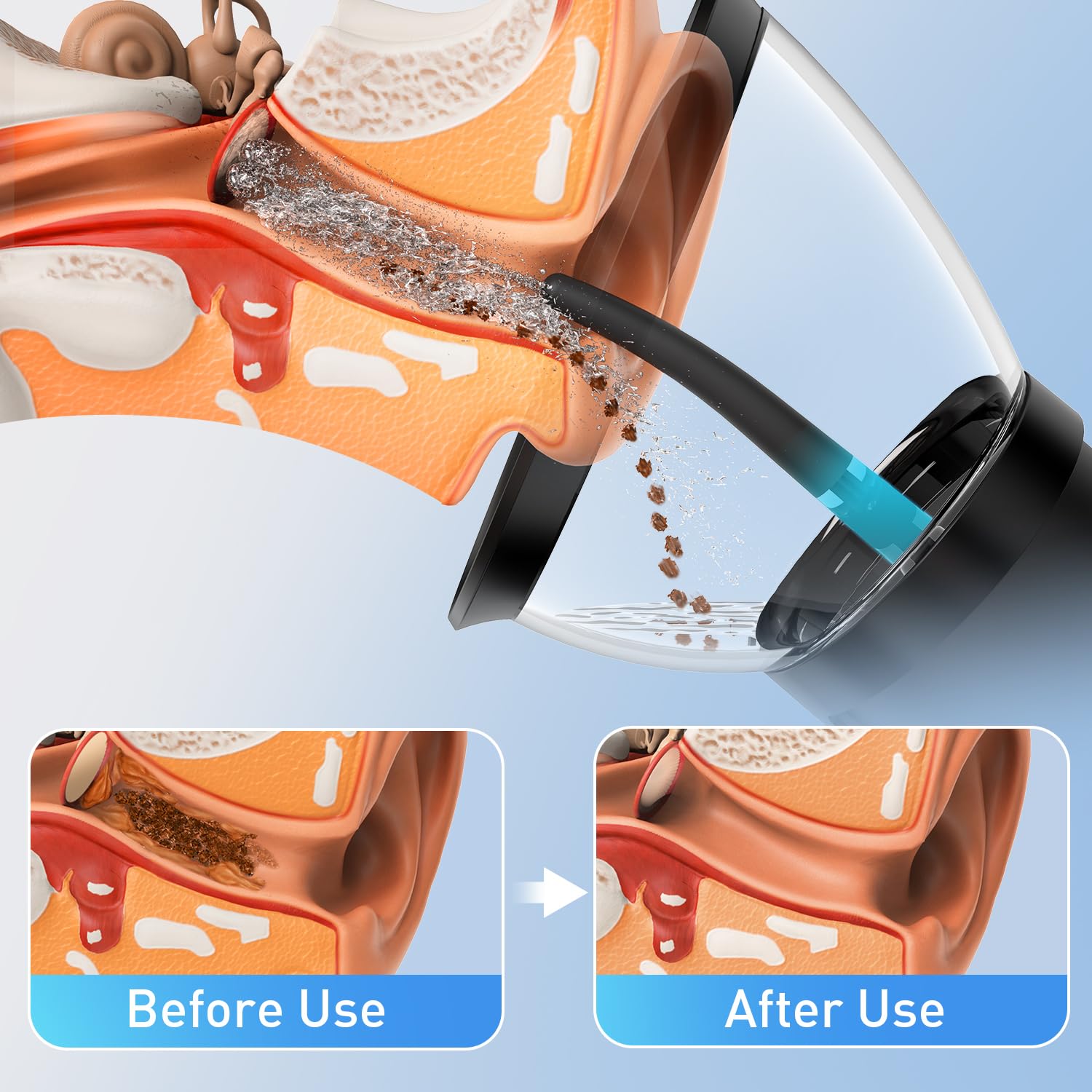 HeaDot limpieza-oreja-agua: irrigación para uso diario.