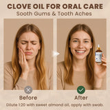 HIQILI Aceite de clavo para cuidado bucal: uso diario y sabor refrescante.