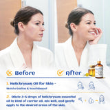 Difusor HIQILI Helichrysum emite aroma suave y calmante en casa.
