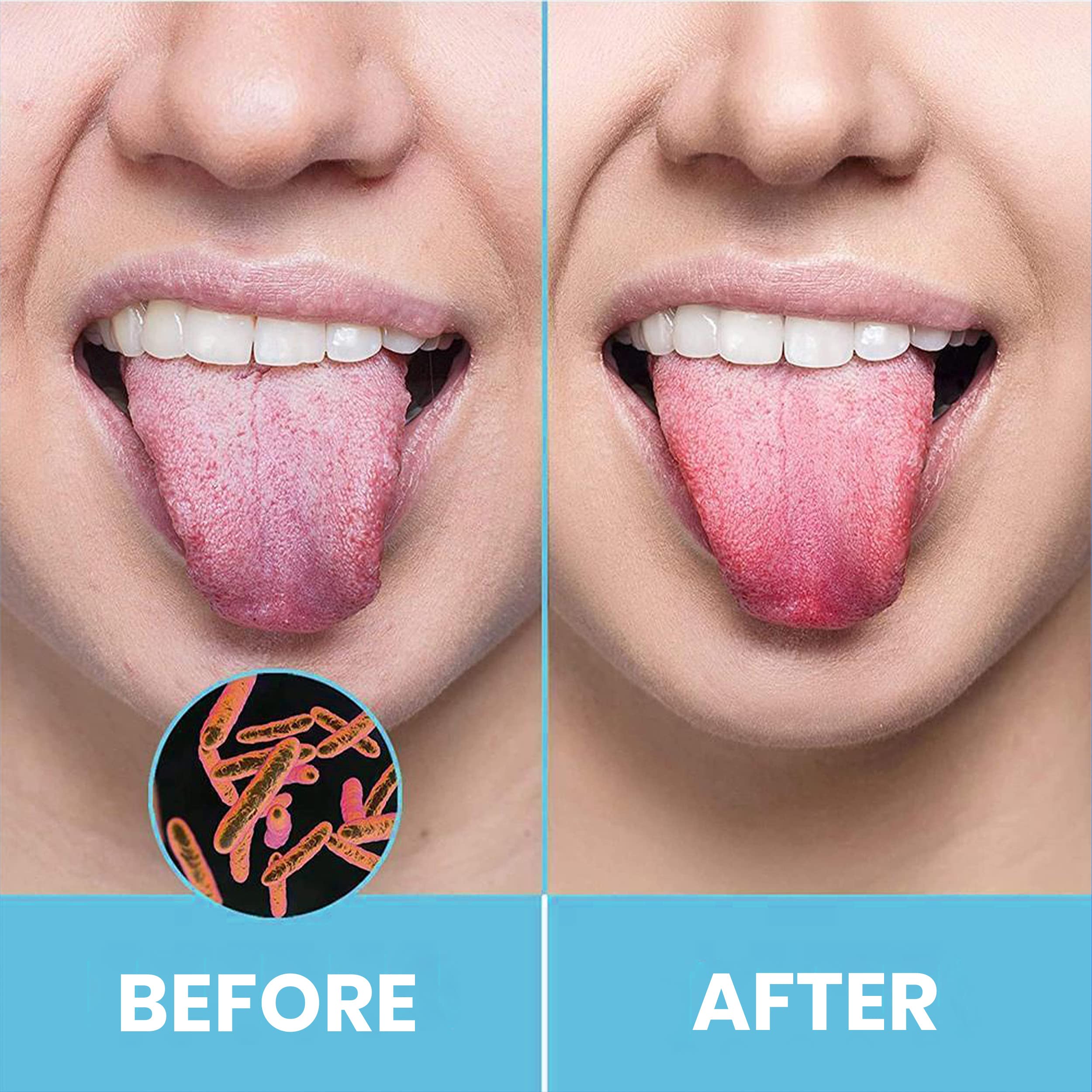 Limpia lengua HOKIN con diseño ergonómico para uso cómodo diario.