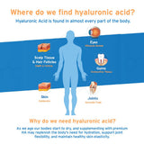 Hyalogic Synthovial Siete cuenta gotas dosifica ácido hialurónico con precisión