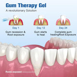 iaredon Taileden Gel nutrientes encías: nutrientes directos para el tejido gingival.