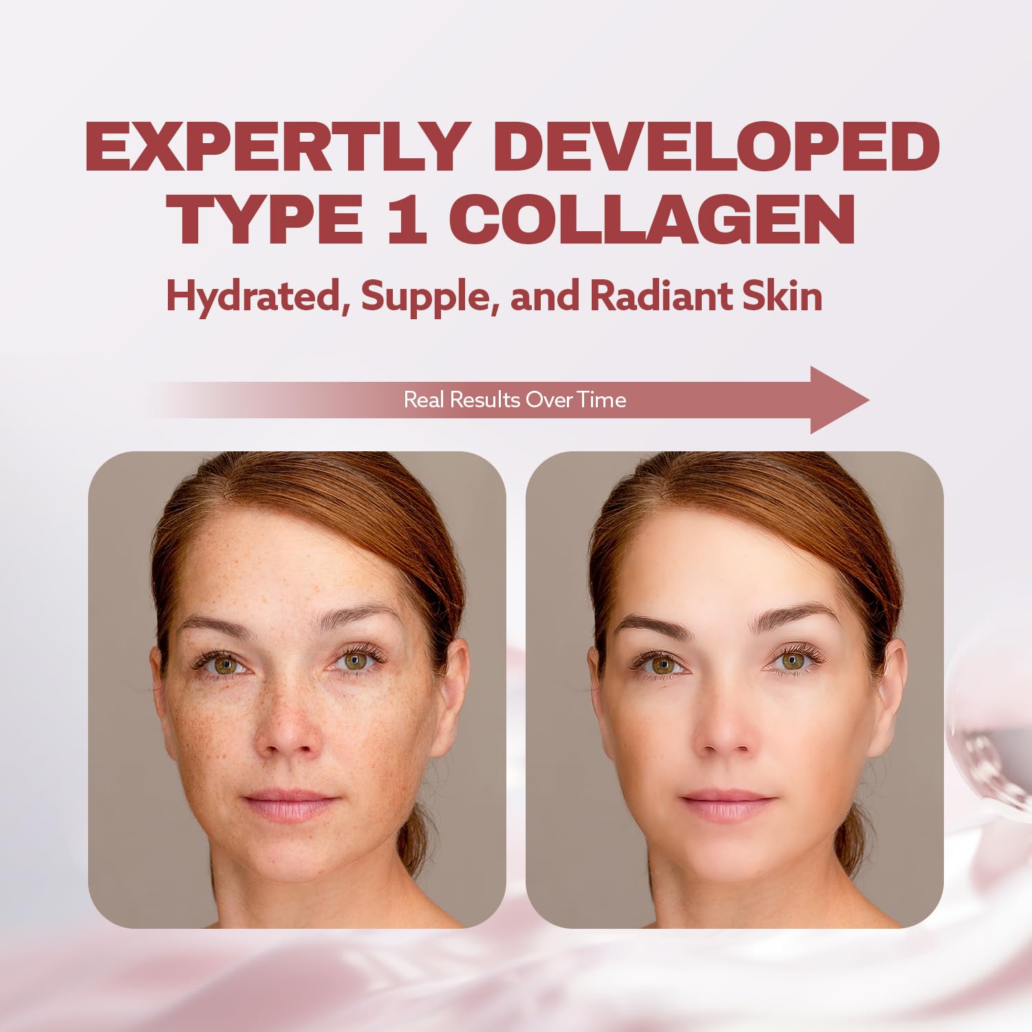 ILO hecho en Corea garantiza tradición de belleza y control de calidad.