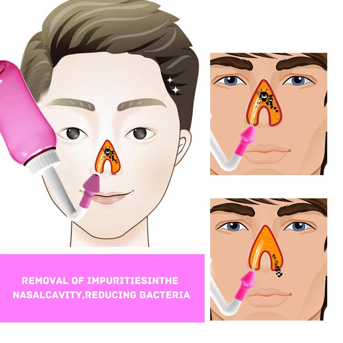 ILSSLI Neti Pot diseño a prueba de fugas y portable