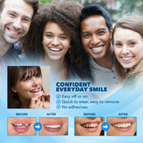 Imako Premium Cosmetic Uppers ajuste casero para sonrisa discreta en casa