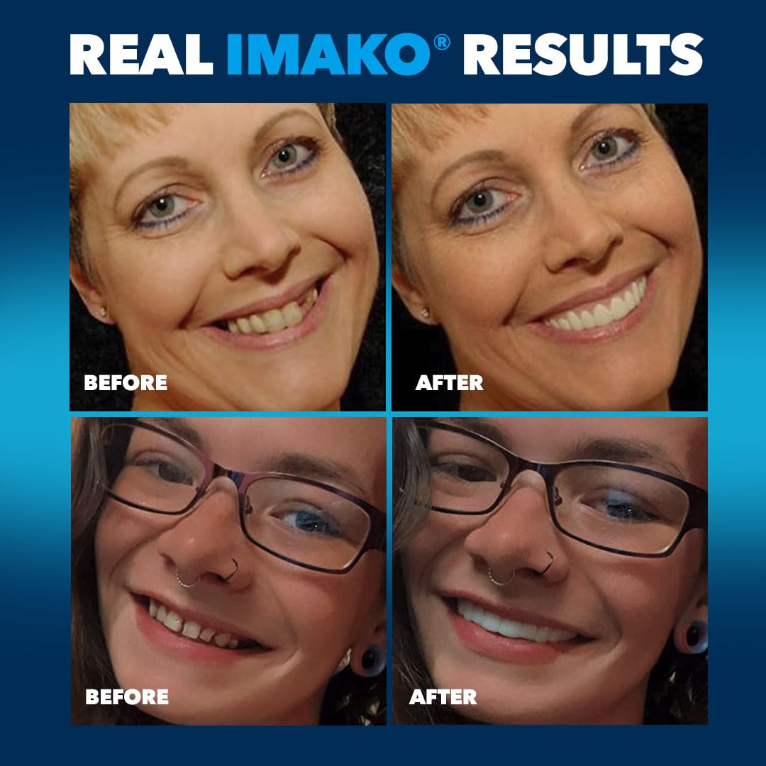 Imako Premium Cosmetic Uppers tamaños Pequeño y Grande para diferentes bocas