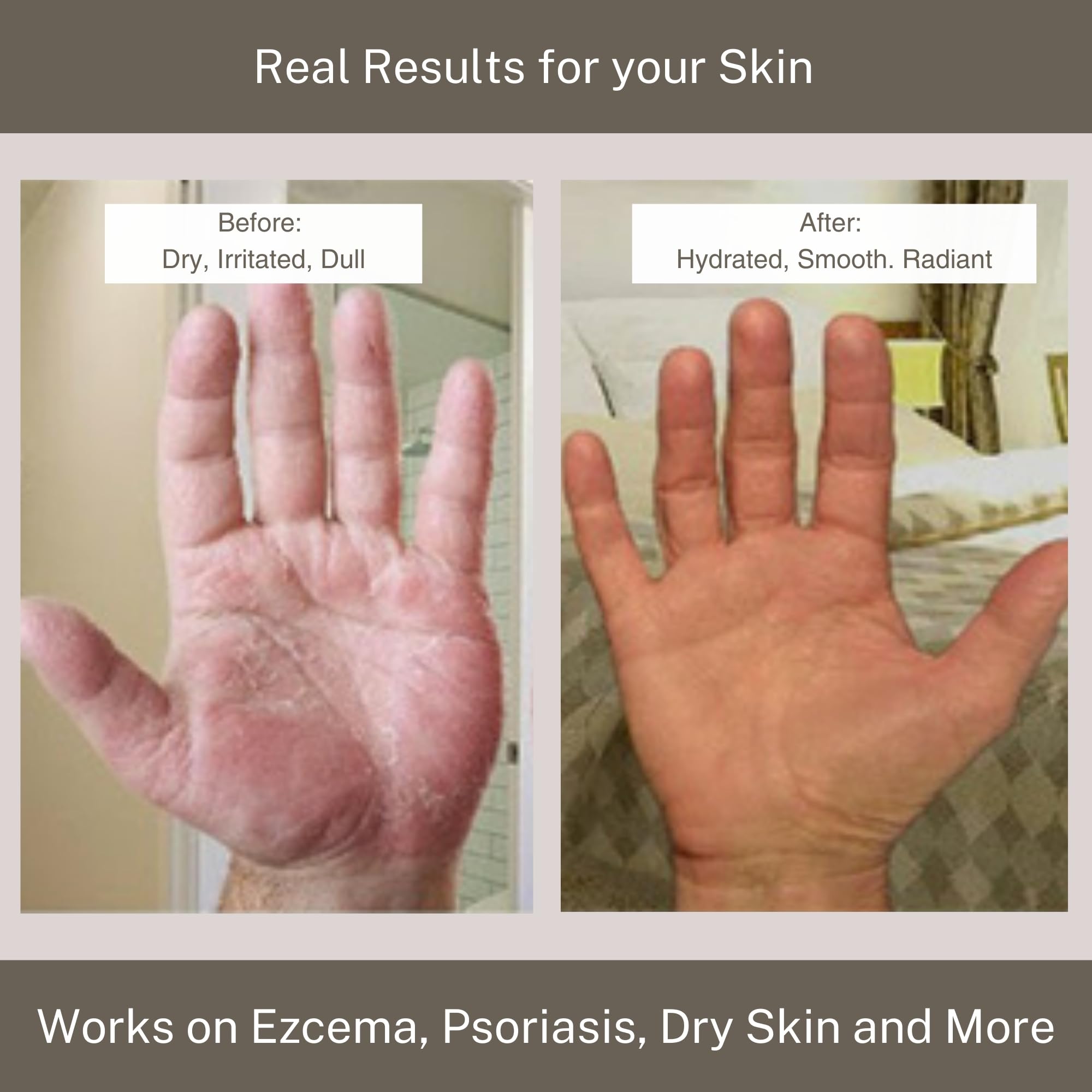 InfiniteAloe crema, uso diario, mantiene la piel hidratada y cómoda.
