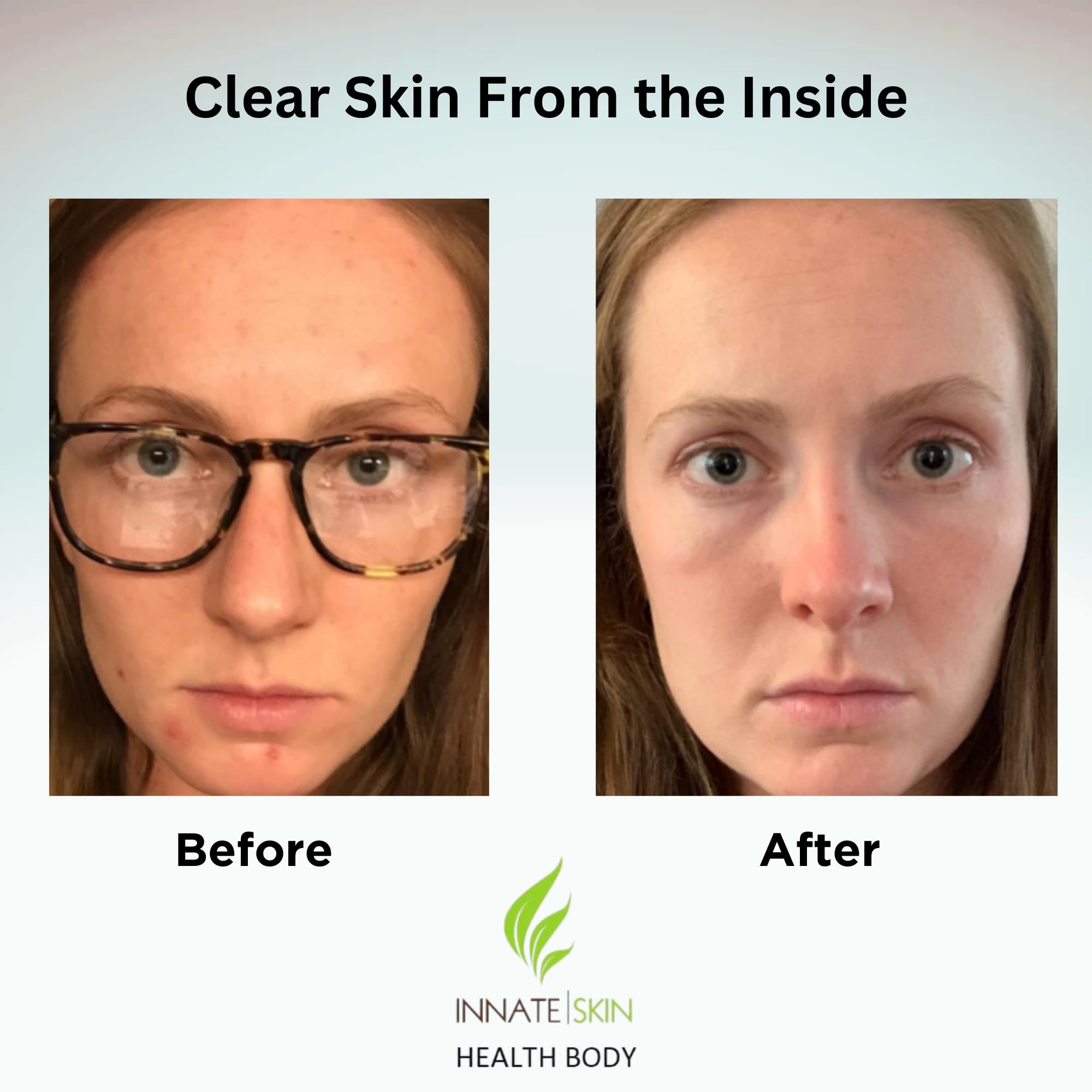 Innate Skin etiqueta frontal: envase visible, información clara para decisiones informadas.