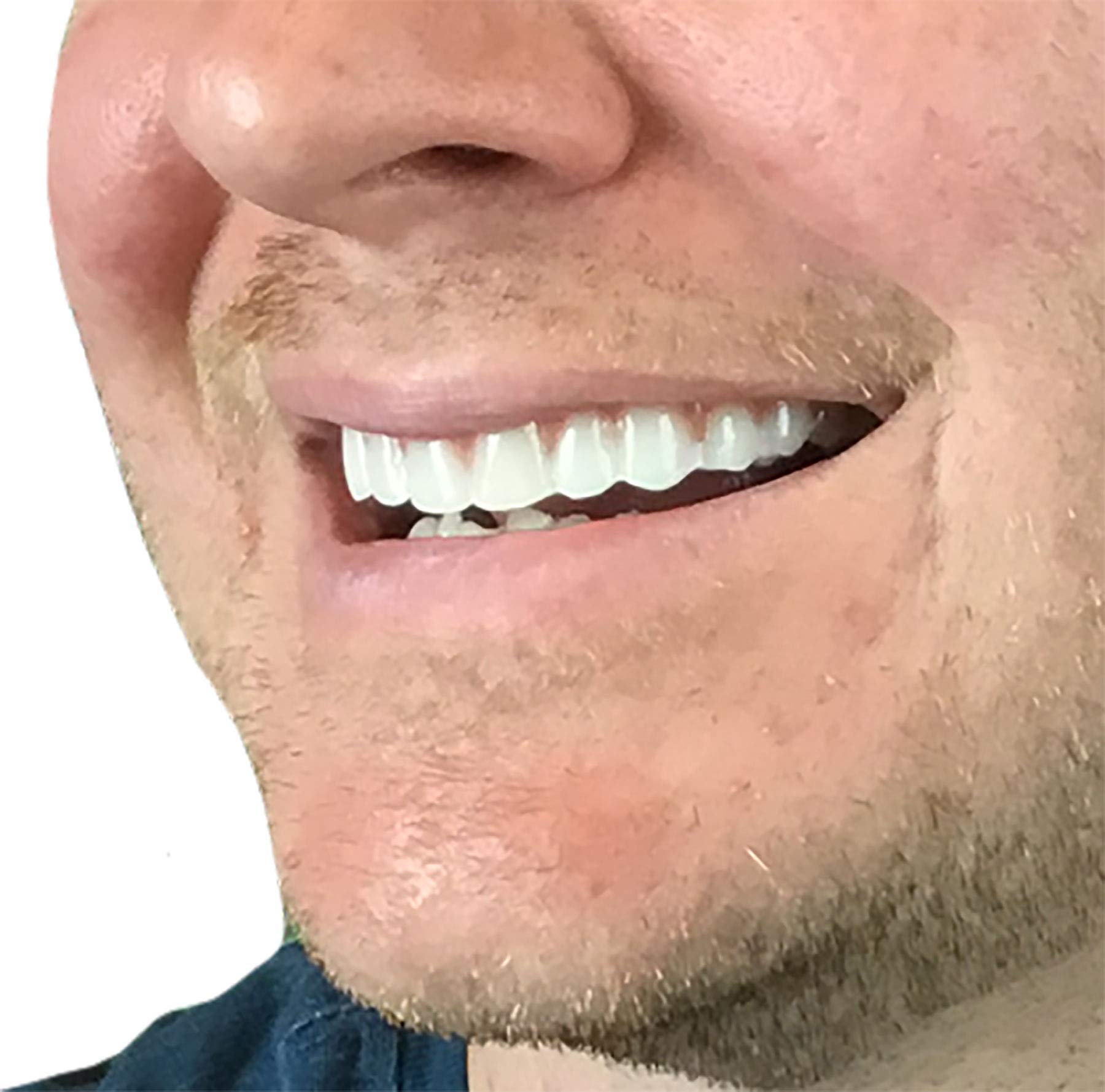 Instant Smile Comfort Fit Flex mostrando ajuste cómodo para uso prolongado.