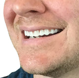 Instant Smile Comfort Fit Flex mostrando ajuste cómodo para uso prolongado.