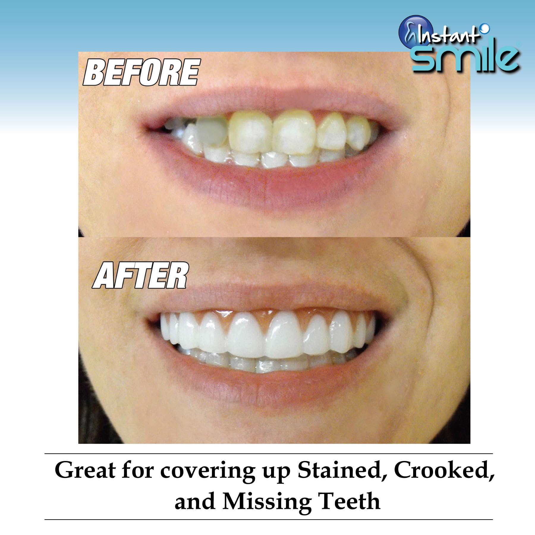 Instant Smile Comfort Fit Flex con tecnología ultra fina para hablar sin distracciones.