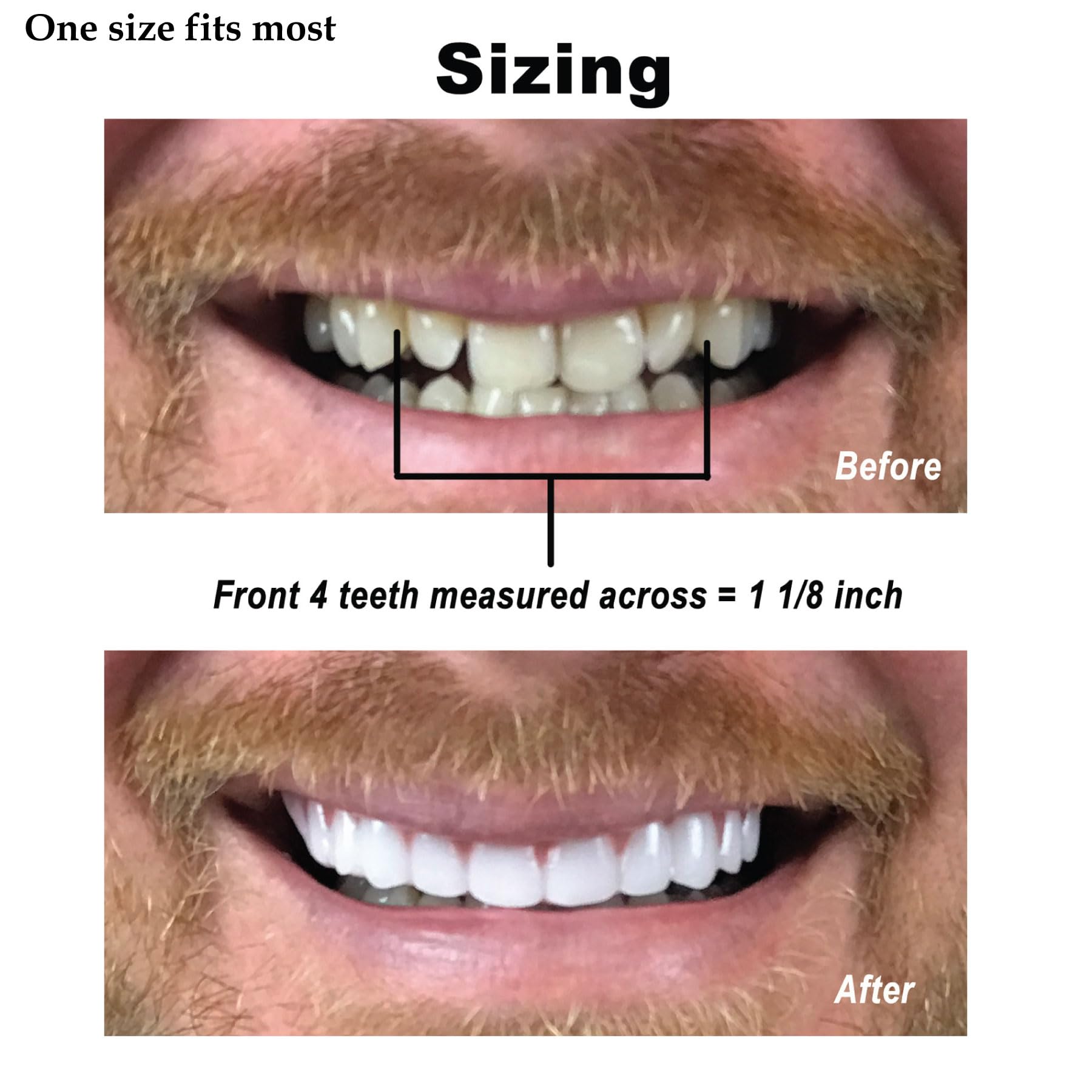Instant Smile Comfort Fit Flex resalta dientes superiores y guía de tallaje.