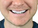 Instant Smile Flex 2pk, uso rápido para una sonrisa mejor en minutos.