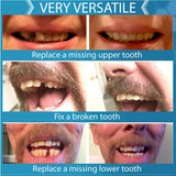 Instant Smile reemplazo diente superior para completar la sonrisa.