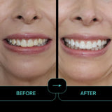 IntelliWHiTE ProStrips: sonrisa más brillante tras uso continuo.