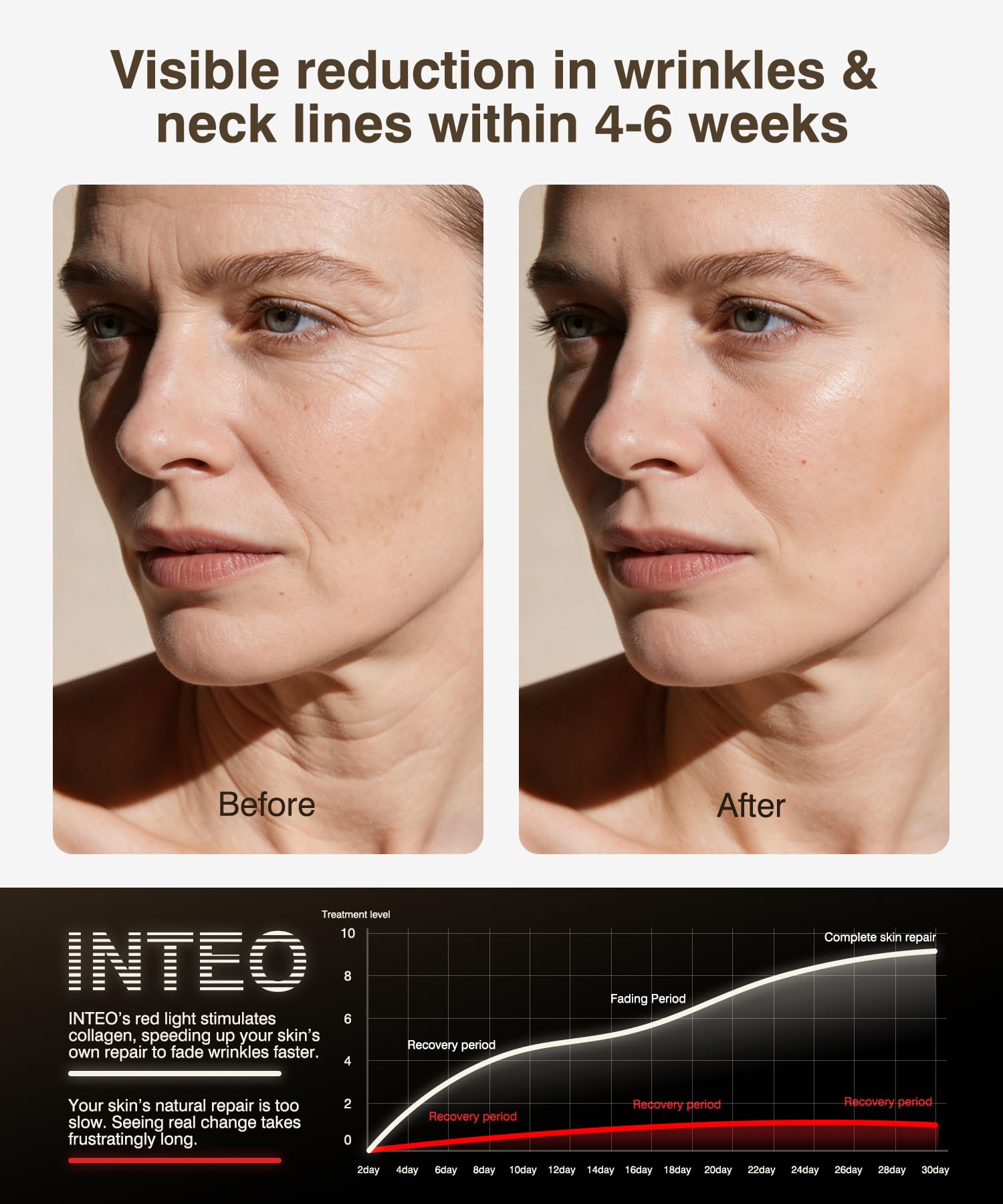 INTEO luz roja 630nm para favorecer luminosidad y firmeza suave