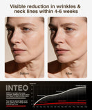 INTEO luz roja 630nm para favorecer luminosidad y firmeza suave