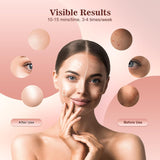 INTEO mascarilla luz amarilla 590nm para equilibrar tono y brillo.