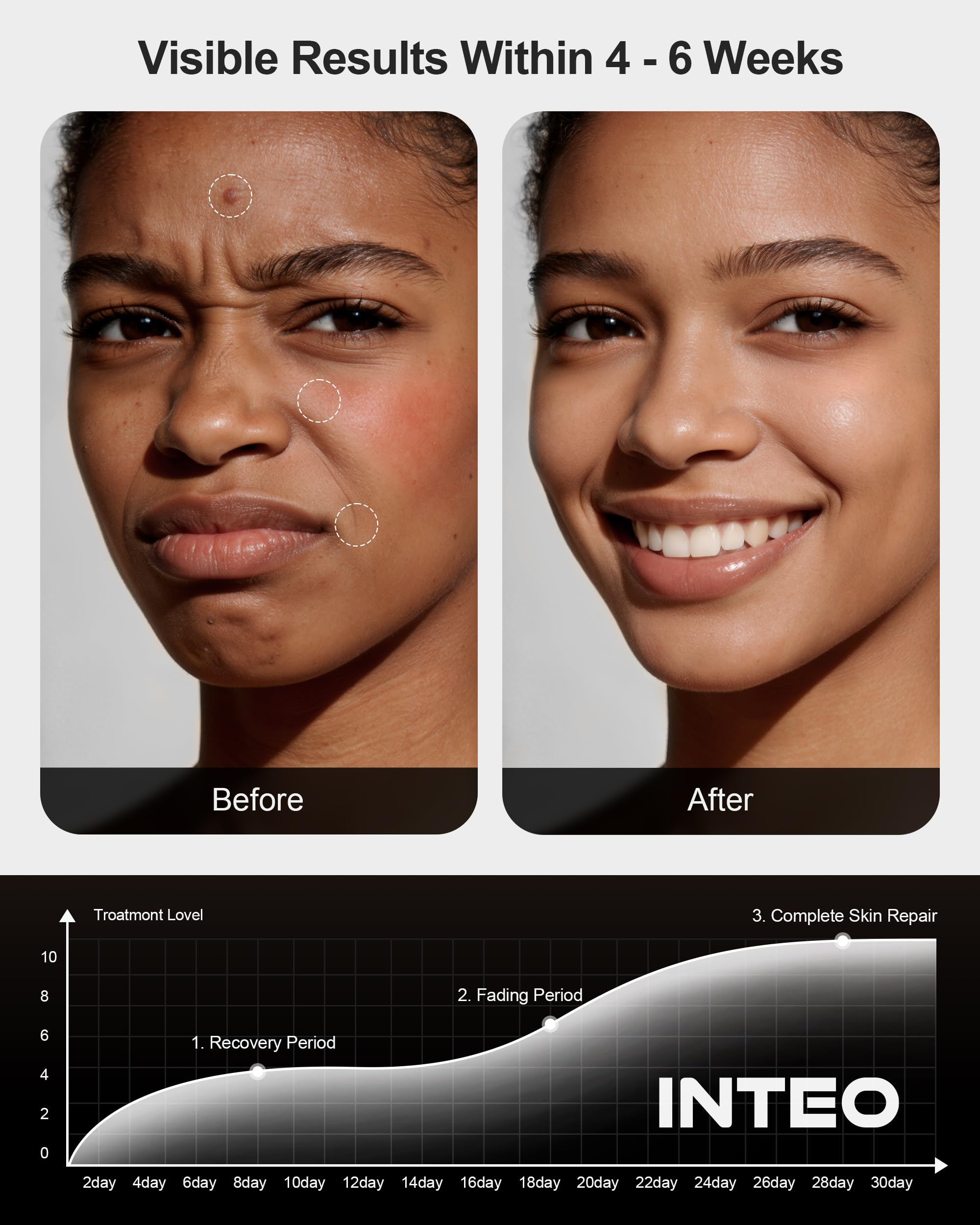 INTEO uso nocturno para relajar rostro y espalda