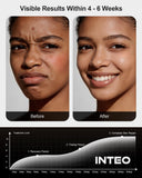 INTEO uso nocturno para relajar rostro y espalda