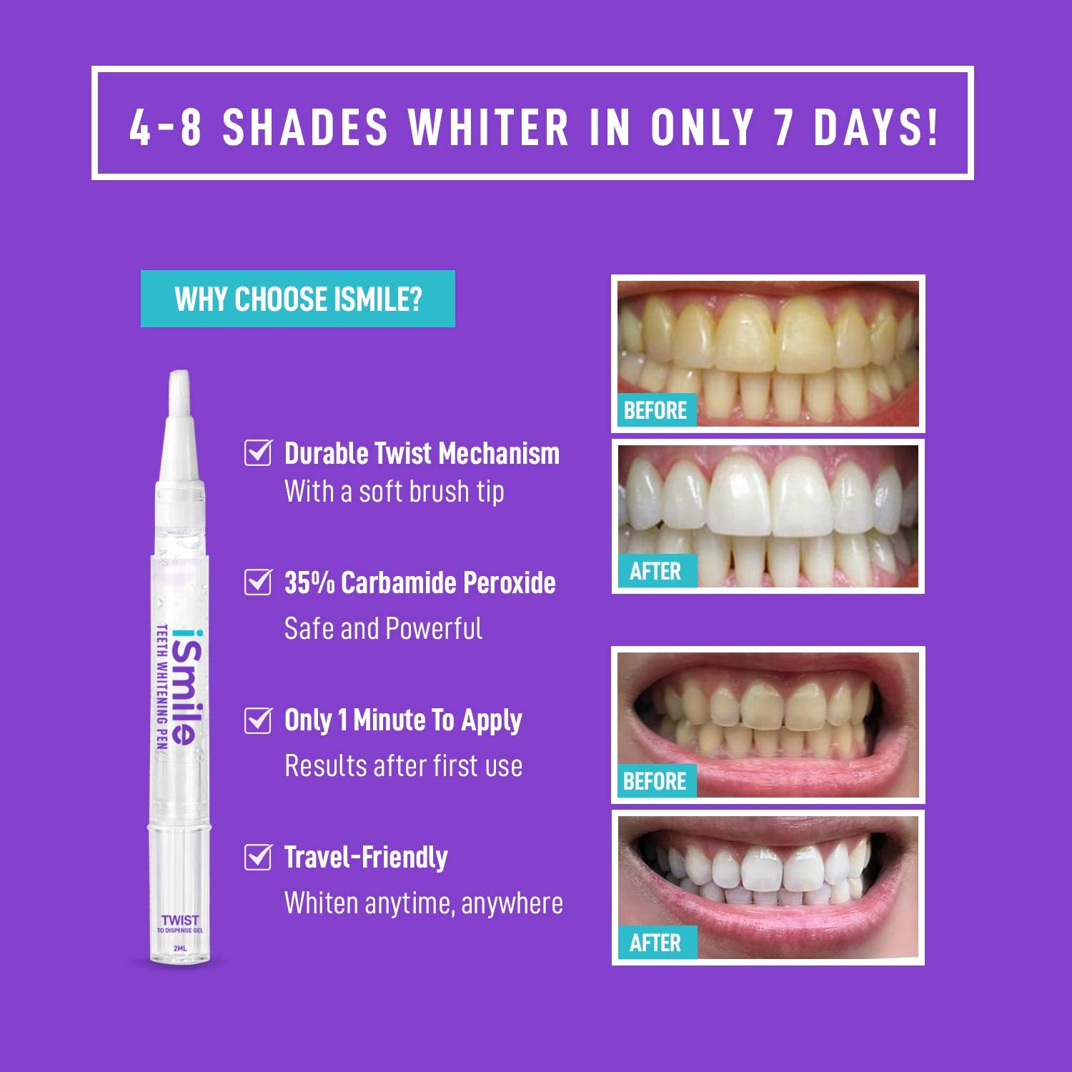 iSmile Whitening gel 35% para blanqueado seguro sin sensibilidad.