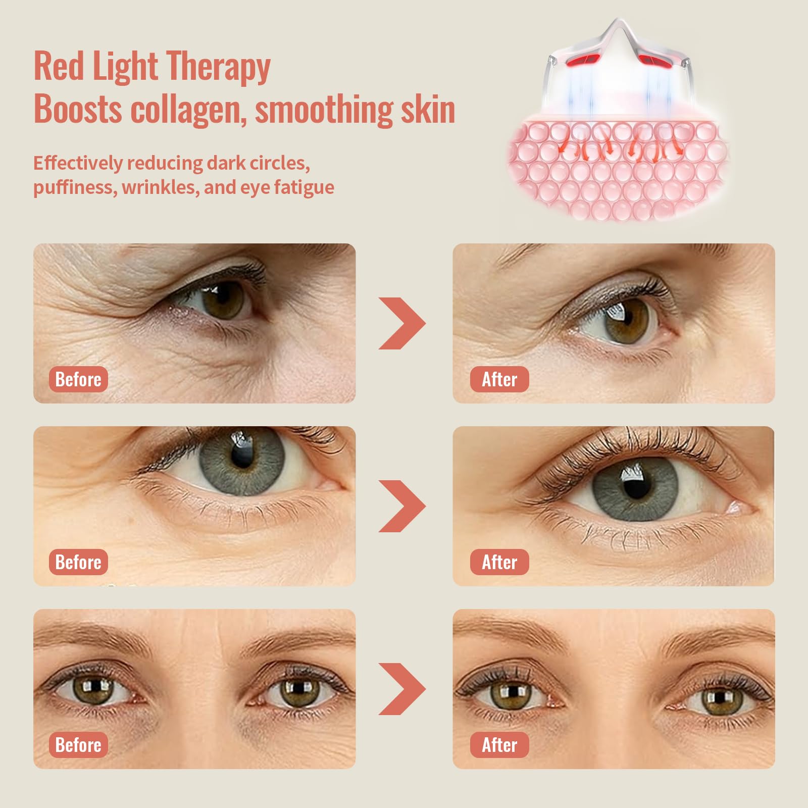 JCOTTON lentes-luz-roja-uso-diario permiten reducir ojeras y cansancio con uso constante.