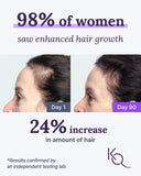 Keranique: suplementos capilares con nutrición diaria para cabello saludable.