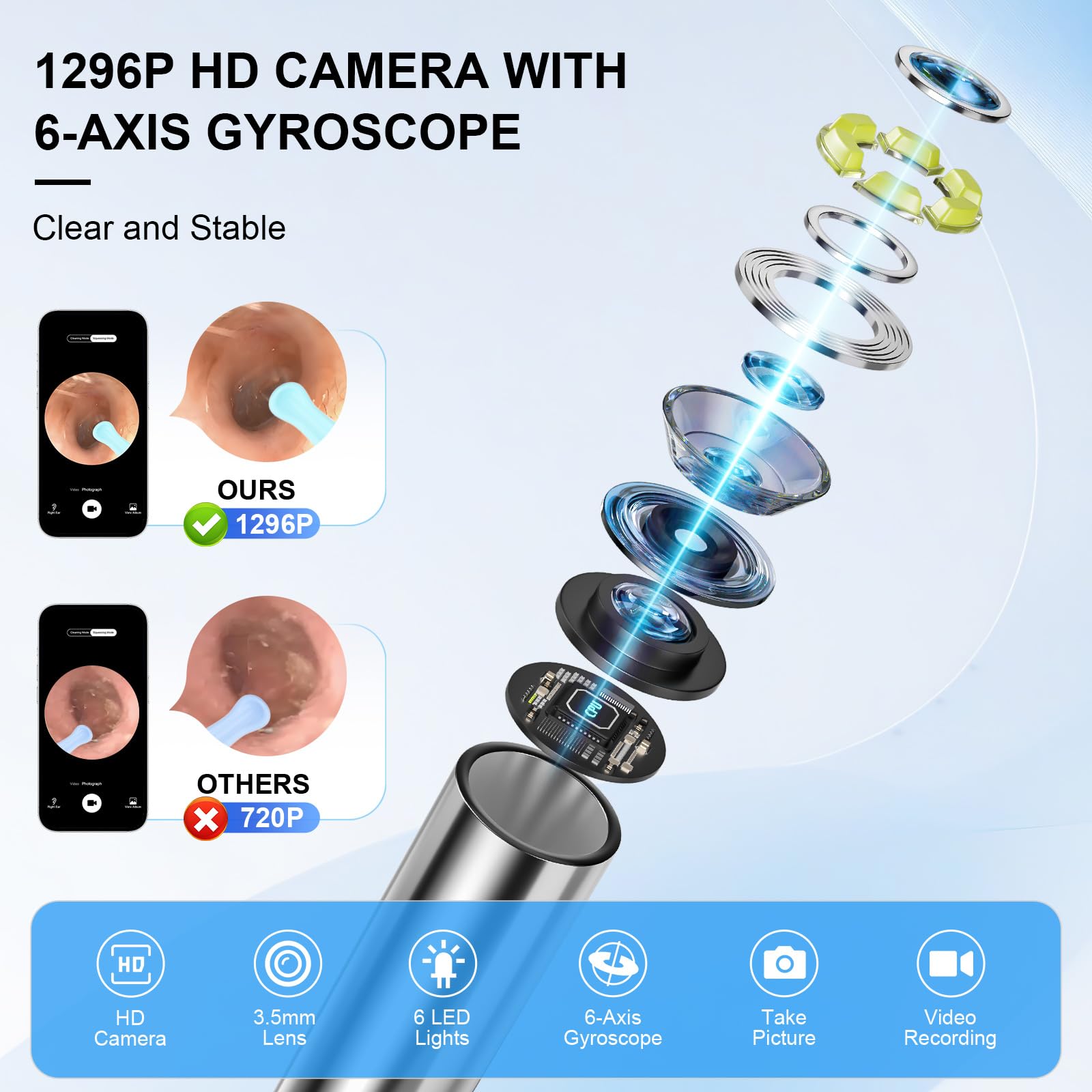 Keyloland visión 360 de la oreja para inspección completa.