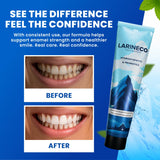 Larineco: dientes brillantes para un esmalte suave y uniforme.