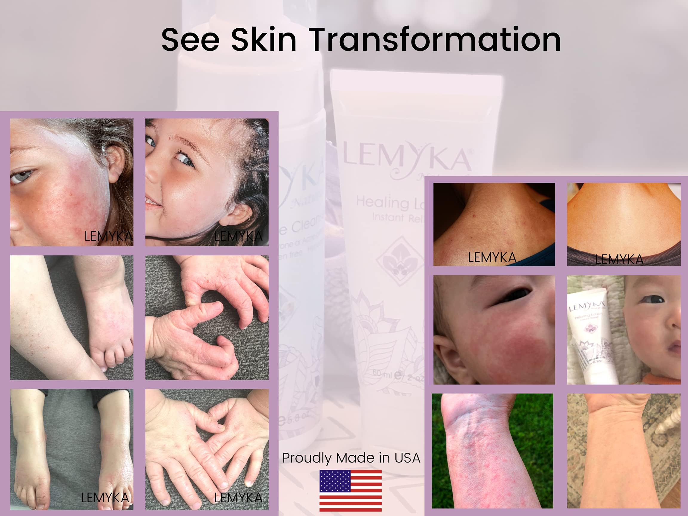 LEMYKA limpiador facial como complemento para piel sensible