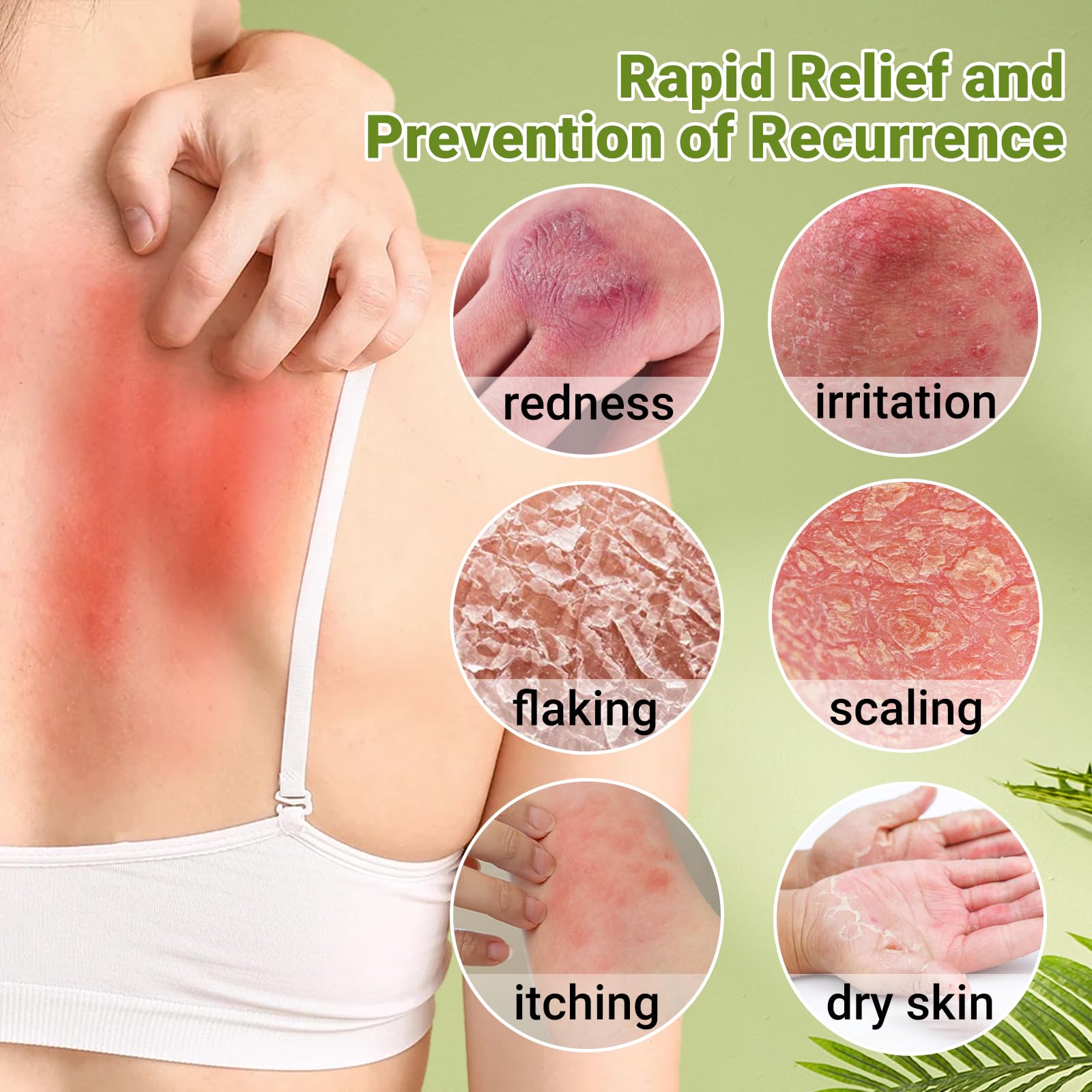 LMNOOP crema psoriasis absorcion rapida para uso diario