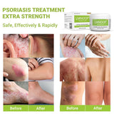 LMNOOP crema psoriasis cuero cabelludo alivio suave