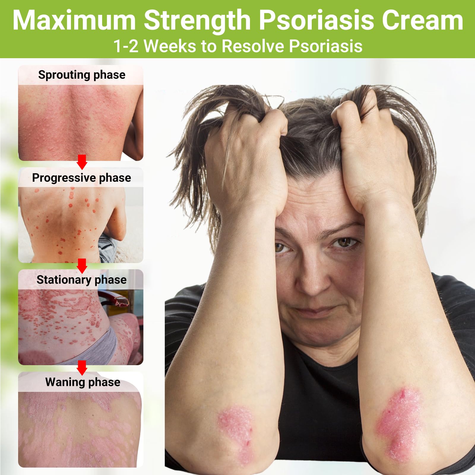 LMNOOP crema psoriasis textura suave al contacto con la piel
